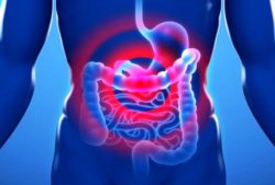 Sindrome dell’intestino irritabile