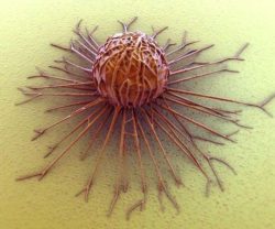 Trattamento del melanoma
