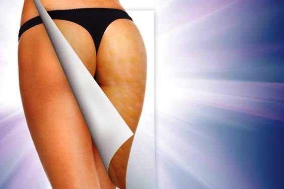 Cellulite? Andiamole contro! – seconda puntata