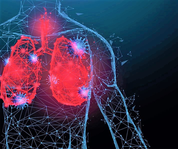 I pazienti con BPCO: l’importanza di proteggere i polmoni dallo stress ossidativo