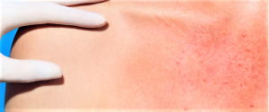 La Roche-Posay e la salute della pelle: conoscenze & rimedi #saveyourskin