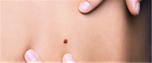 La Roche-Posay e la salute della pelle: conoscenze & rimedi #saveyourskin