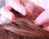 I  mal di testa? Toglieteli dalla testa con l’agopuntura