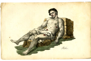 Manzoni 1873–2023 La Peste, orribile flagello, tra vivere e scrivere