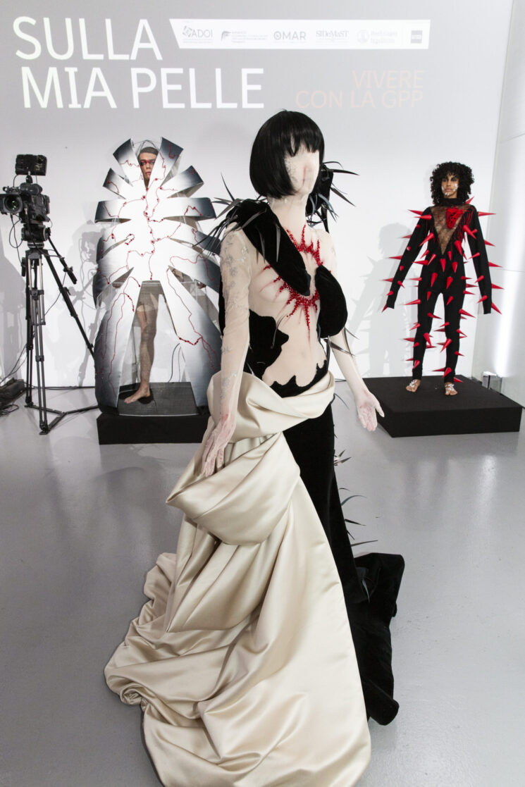 Accademia del Lusso: Unwearable Collection, una sfilata che racconta il vissuto dei pazienti con psoriasi pustolosa generalizzata